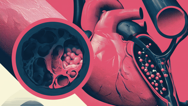 Ensayo Lp(a)HORIZON: Un Paso Crucial en la Reducción del Riesgo Cardiovascular
Mediante la Disminución de Lipoproteína(a)